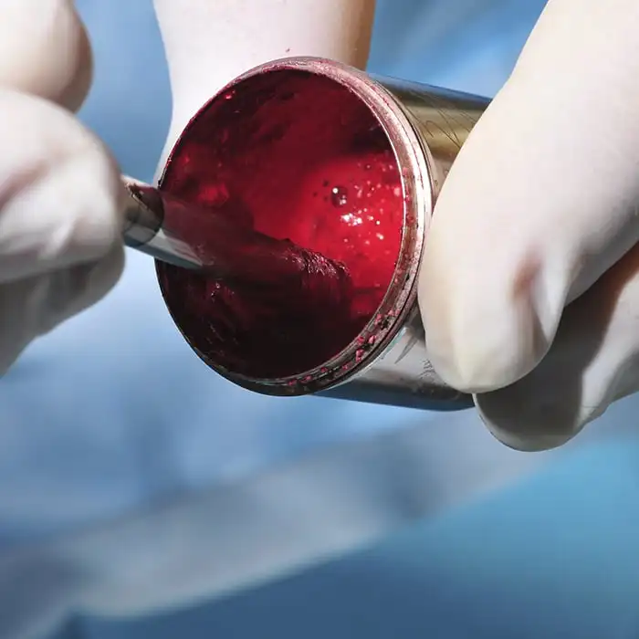 Roundup Ru 200 Integrated Mixing Machine For Intrinsic And Extrinsic