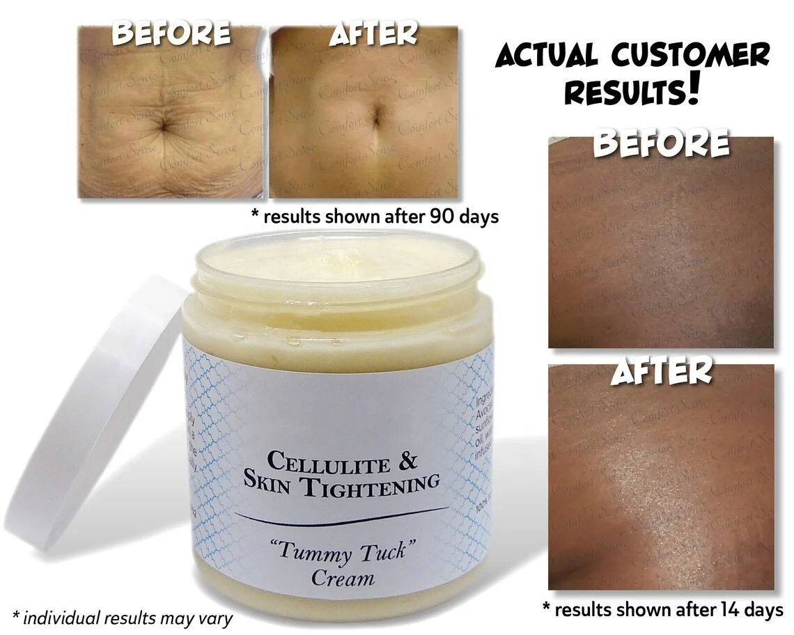 Cellulite & Skin Tightening “Tummy Tuck” Cream – Comfort Sense