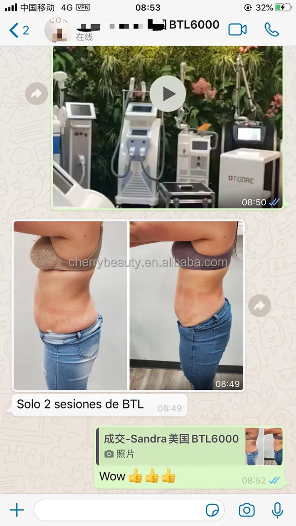 BTL exilis good reviews..jpg